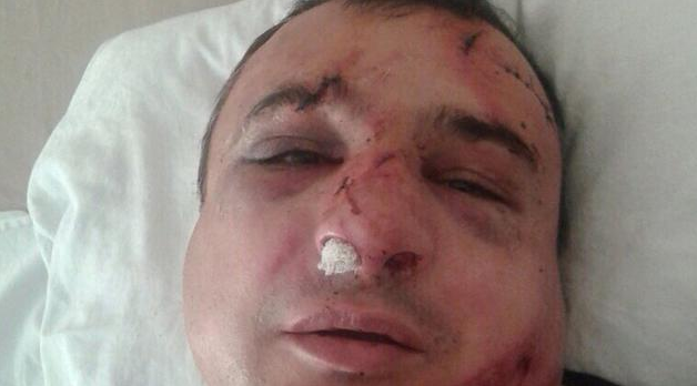 В Киеве избили известного луганского сепаратиста Арсена Клинчаева